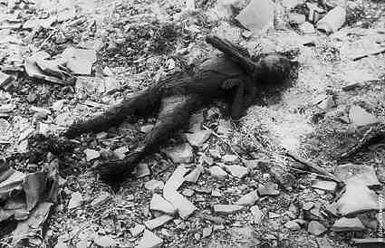 Nagasaki Bomb Victim